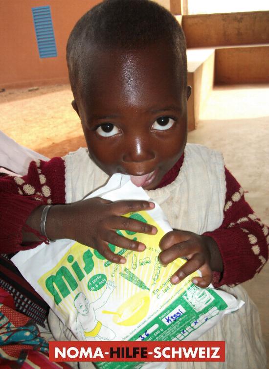 Milchpulver für Kleinkinder im Centre Nopoko